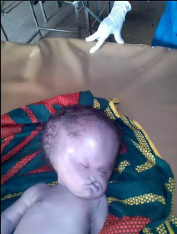 Facebook user shares photo of a baby born deformed due to use of contraceptives by the mother